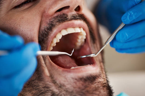 Best Emergency Dentist for Knocked-Out Tooth in Commack, NY